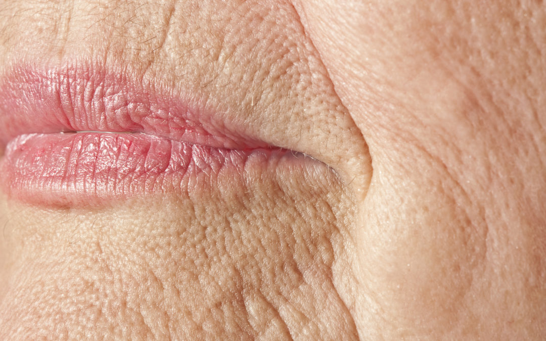 Código de Barras: como tratar as rugas ao redor dos lábios